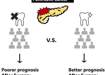 Denti naturali legati alla sopravvivenza dopo il cancro al pancreas